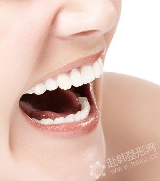 什么是舌侧矫正牙齿？