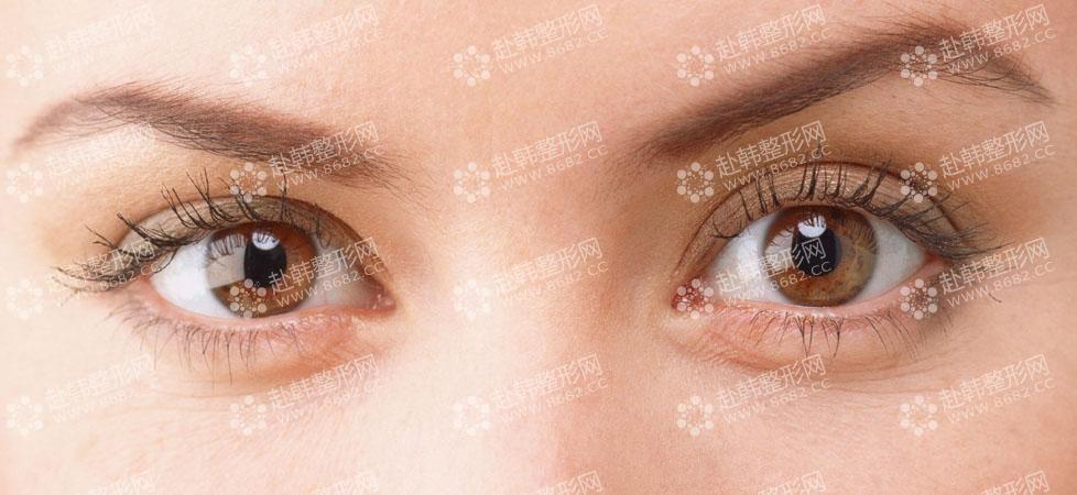 双眼皮修复 需要做切开双眼皮的情况有哪些？