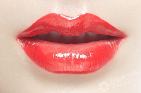 自体脂肪丰唇5大优点 塑造性感唇