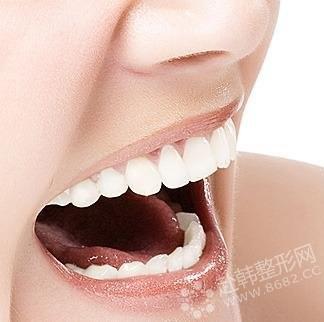 护齿固齿牙龈保健十个方法
