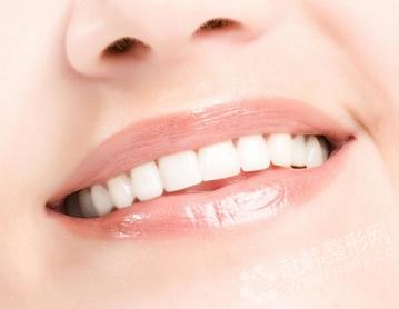 8682专家介绍牙齿美白的主要方法