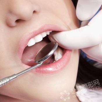 8682介绍种植牙术后护理及使用期护理