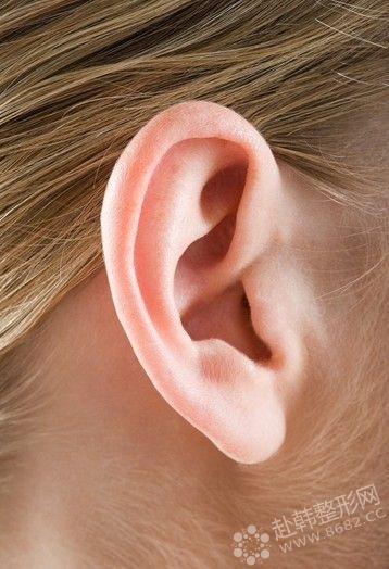 耳部整形的种类分为哪些？