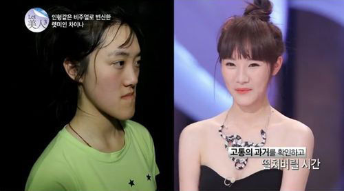 中国“恐龙女”上韩国整容节目《let美人》变漂亮芭比
