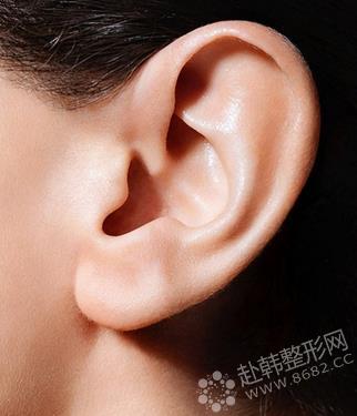 耳部整形详解 塑造耳朵