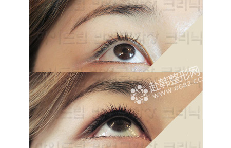 韩式纹眼线前后对比照片