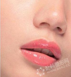 什么是漂唇 漂唇好吗 漂唇术后可能出现的并发症有哪些