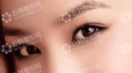 韩式双眼皮 造就眼部整形的经典